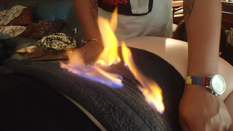Fire therapy