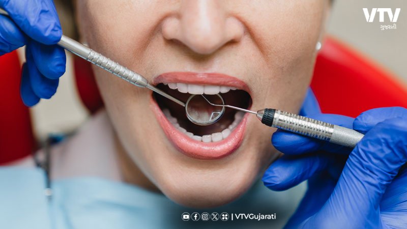 Dental diseases