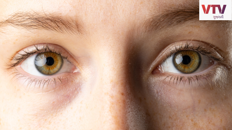Eyes (2)