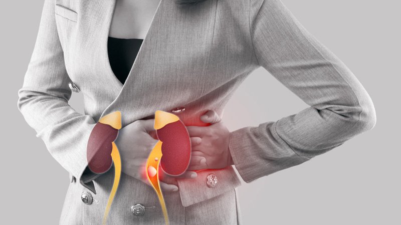 Kidney-Stone.jpg