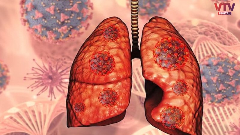 LUNGS-2