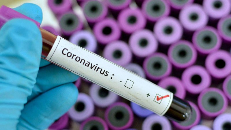 corona-virus (3).jpg