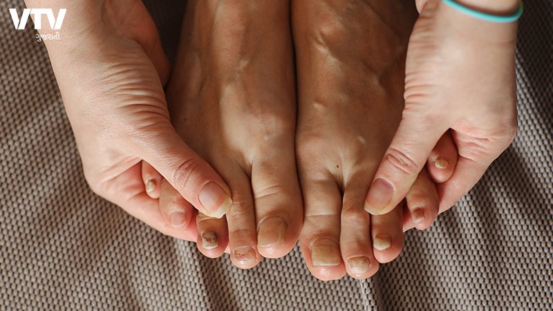 feet-1