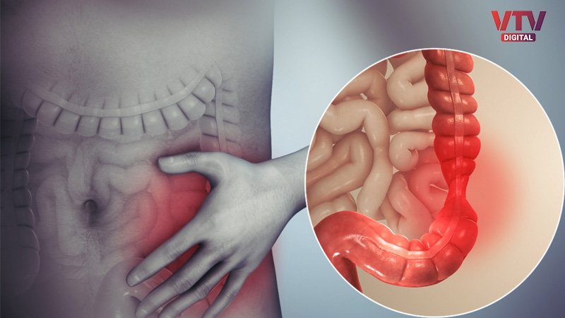 gut-health