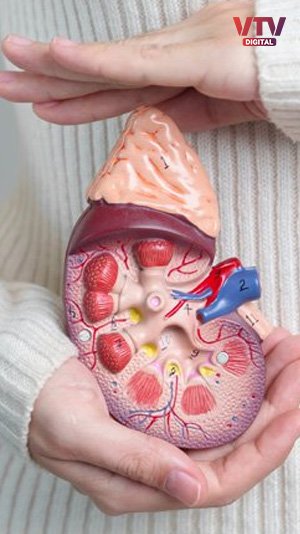kidney-3
