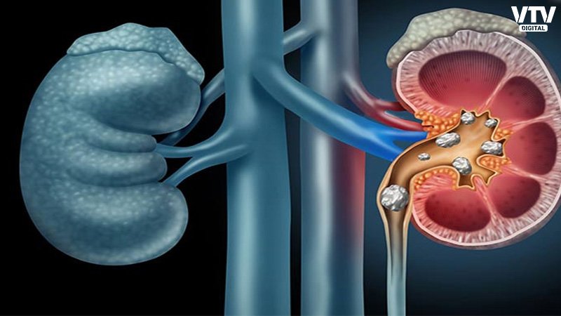 kidney-final