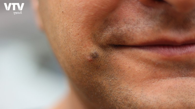 mole-2