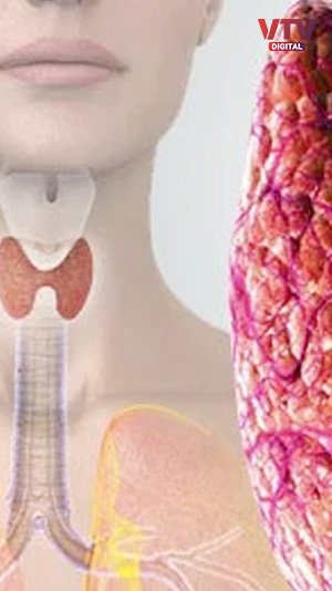 thyroid-6