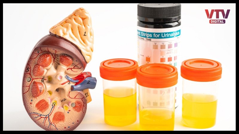 uric-acid-2