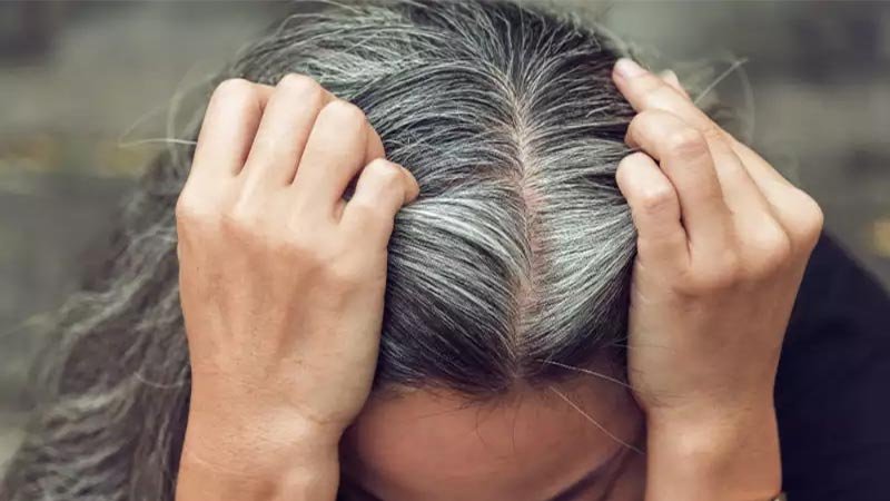 white-hair_0