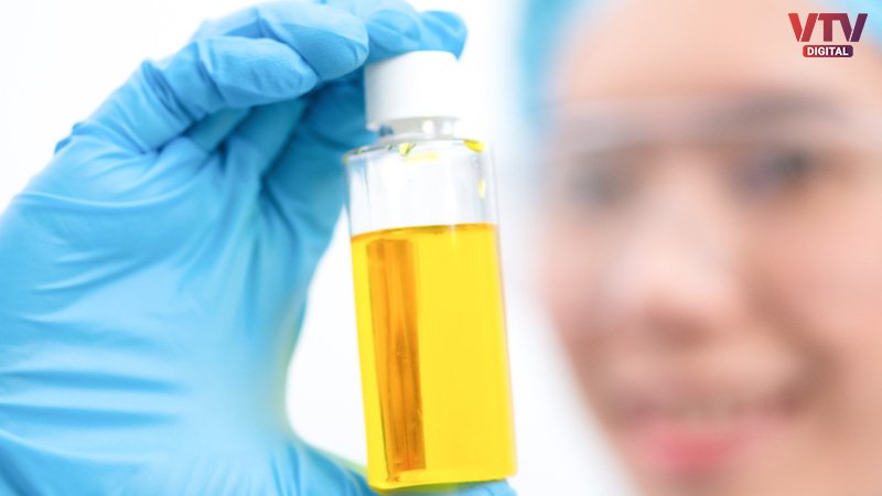yellow-urine-sample